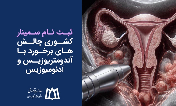 اطلاعیه ثبت‌نام سمینار کشوری چالش‌های برخورد با آندومتریوزیس و آدنومیوزیس